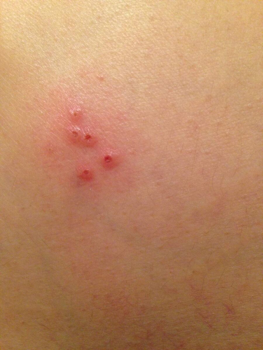 Kammerjäger für Flöhe