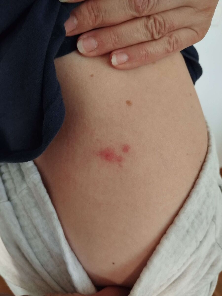 Kammerjäger-in-Zell (ZH)-Inspektion.jpeg